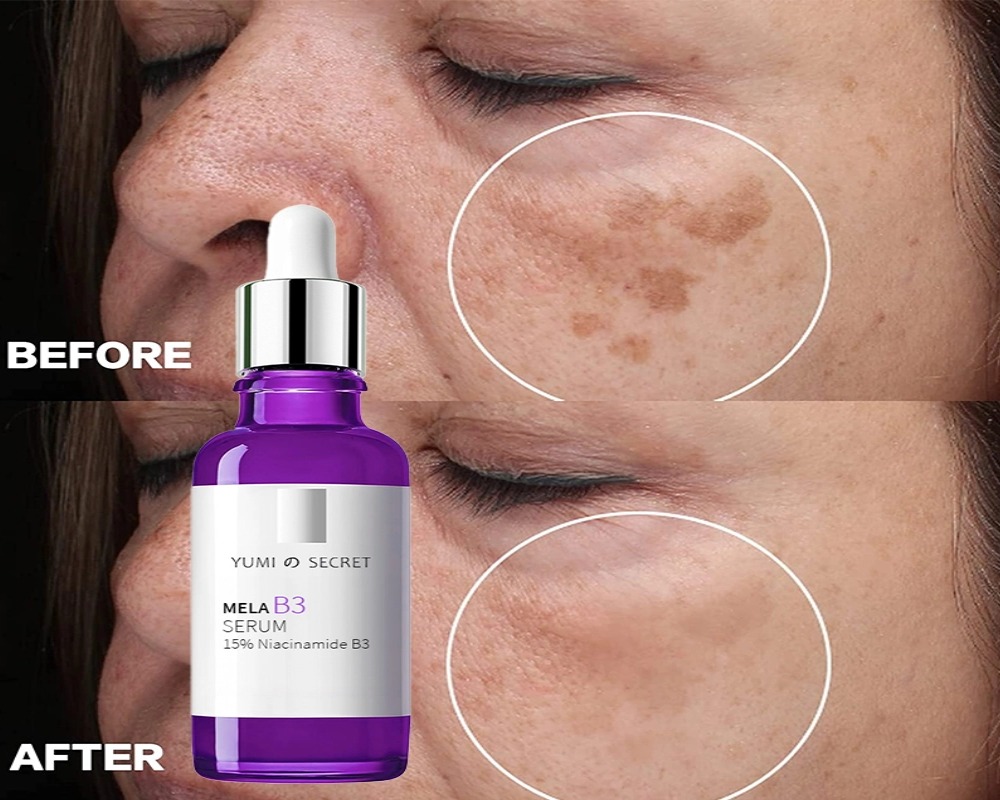 custom niacinamide serum